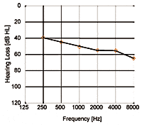 Procedural Considerations for a Loudness Perception Profile for Children