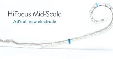 AB Receives FDA Approval for New HiFocus Mid-Scala Electrode