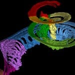 Synchrotron Imaging Informs Customized Cochlear Implant Programming