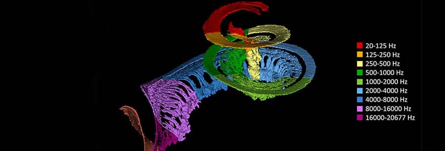 Synchrotron Imaging Informs Customized Cochlear Implant Programming