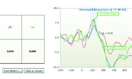 Effects of Amplification on Cortical Electrophysiological Function