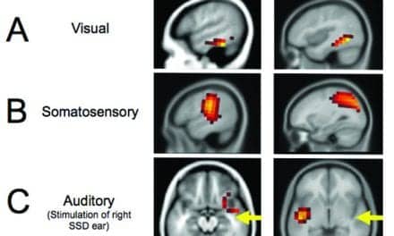 Cortical Neuroplasticity in Hearing Loss: Why It Matters in Clinical Decision-Making for Children and Adults