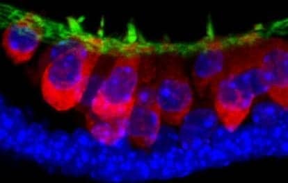 Indiana University Researchers Create Inner Ear Structures from Stem Cells