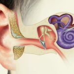 Radiomics Can Predict Hearing Conditions in Vestibular Schwannoma Patients