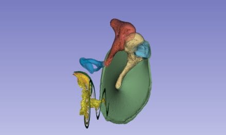 Researchers Map Blood Vessels of Inner Ear