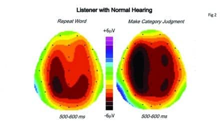 Clinical Speech Audiometry in the Age of the AERP