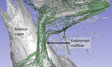 Drainage System Thought to Play a Role in Meniere’s Disease Identified