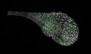 Endolymphatic sac from the inner ear of a mouse.