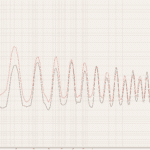 Frequency Raising: Perhaps the Time Has Come?