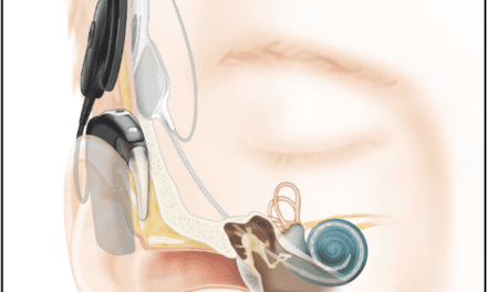 When Is an Implantable Hearing Solution Appropriate?